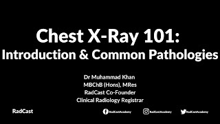 RadCast Academy Introduction To The Chest XRay amp Common Pathologies cxr radcast [upl. by Atirma]