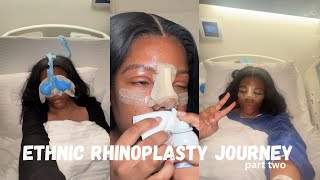 ETHNIC RHINOPLASTY  DR BORA OK  part two [upl. by Anin]