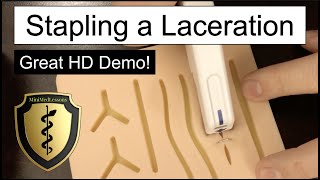 Closing a Laceration Using a Skin Stapler  Stepbystep instructions [upl. by Ailen]