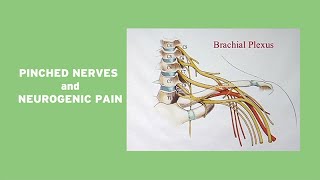 Pinched Nerves and Neurogenic Pain [upl. by Nelan]