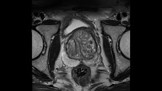 Ultrasound Tutorial Kidney amp Bladder  Urinary Tract  Radiology Nation [upl. by Staley930]