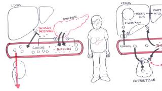 Diabetes Type II Pathophysiology [upl. by Ellak]