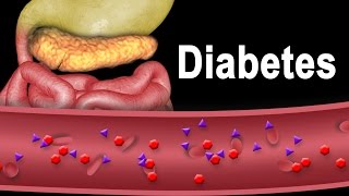 Diabetes Type 1 and Type 2 Animation [upl. by Eneleahcim]