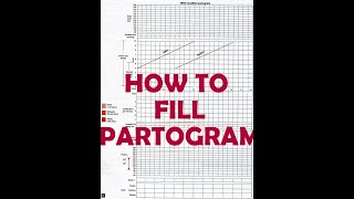 HOW TO FILL PARTOGRAM  VERY EASY [upl. by Torrance278]