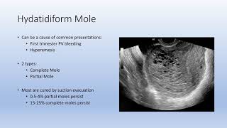 Gestational Trophoblastic Disease GTD [upl. by Lina538]