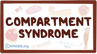 Parkinsons disease  an Osmosis Preview [upl. by Mitchel]