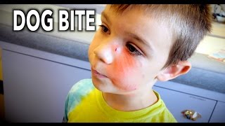 DOG BITE To The FACE Hilarious Kid Tells the Story  Dr Paul [upl. by Munmro]