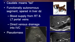 Transabdominal Pelvis Ultrasound Scanning Techniques [upl. by Atrim534]