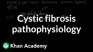 Cystic fibrosis pathophysiology  Respiratory system diseases  NCLEXRN  Khan Academy [upl. by Noslien865]