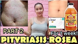 PITYRIASIS ROSEA WHAT’S MY STORY PHILIPPINES [upl. by Fidelas]