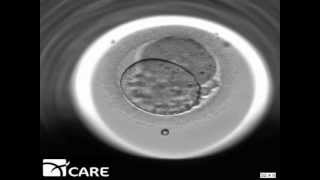 Time Lapse Embryo Imaging [upl. by Aikem]