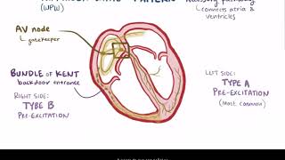 Understanding Parkinsons disease [upl. by Eilime]