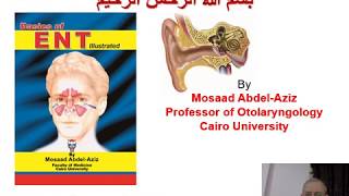 Ear 6 Mosaad AbdelAziz Trauma Tumors amp Otosclerosis [upl. by Ainivad]