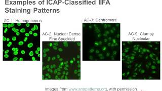 Antinuclear Antibody Testing [upl. by Nosyt199]