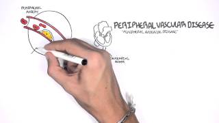 Cardiovascular Disease Overview [upl. by Marou240]