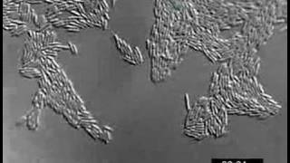 Motility Determination in Bacteria  Amrita University [upl. by Yhtamit]