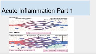 Acute Inflammation Part 1 [upl. by Sucramrej119]