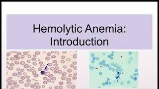 Hemolytic Anemias Introduction and Classification [upl. by Araid]