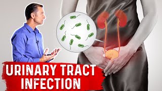 Top Natural Remedies for a UTI Urinary Tract Infection [upl. by Squier862]