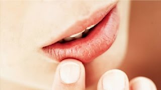 The Basics Canker Sore Causes and Treatments [upl. by Aiza]