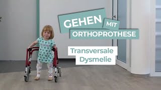 Transversale Dysmelie  Gehen mit Orthoprothesen [upl. by Mckenna]