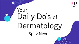 Spitz Nevus  Daily Dos of Dermatology [upl. by Lammond]