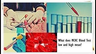 MCHC Blood Test  Low Normal High [upl. by Aihsetel412]