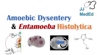 Amebiasis Amoebic Dysentery  Entamoeba histolytica Pathogenesis Signs amp Symptoms Treatment [upl. by Nesyt58]