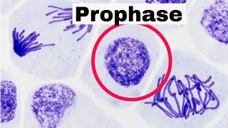 Prophase [upl. by Ricardo]