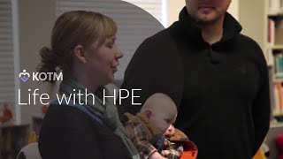 KOTM Parent Stories Holoprosencephaly HPE [upl. by Nylle]