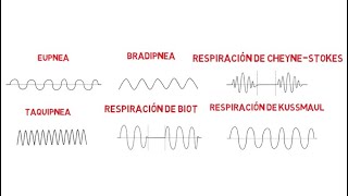 Patrones respiratorios Eupnea Bradipnea Taquipnea Biot CheyneStokes y Kussmaul [upl. by Hairacaz899]