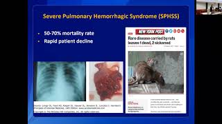 Leptospirosis Clinical Disease and Diagnosis in Humans [upl. by Pollard]