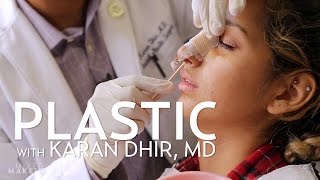 Savannahs Rhinoplasty Surgery Experience  PLASTIC with Dr Dhir [upl. by Fleming]