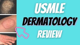 Everything you need to know about Dermatology for the USMLE [upl. by Adnimra]