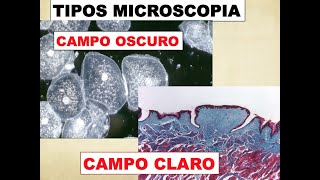 TIPOS DE MICROSCOPIA  CAMPO CLARO Y CAMPO OSCURO [upl. by Izmar]